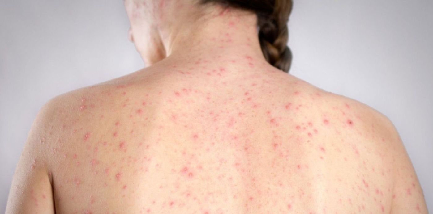 1648403161389.jpg?x=7&y=6&width=1486&height=744&rotate=0&scaleX=1&scaleY=1&ow=1500&oh=843&&cw=1920&ch=950