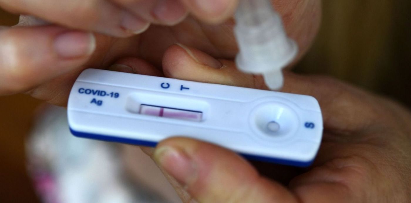 test antígenos