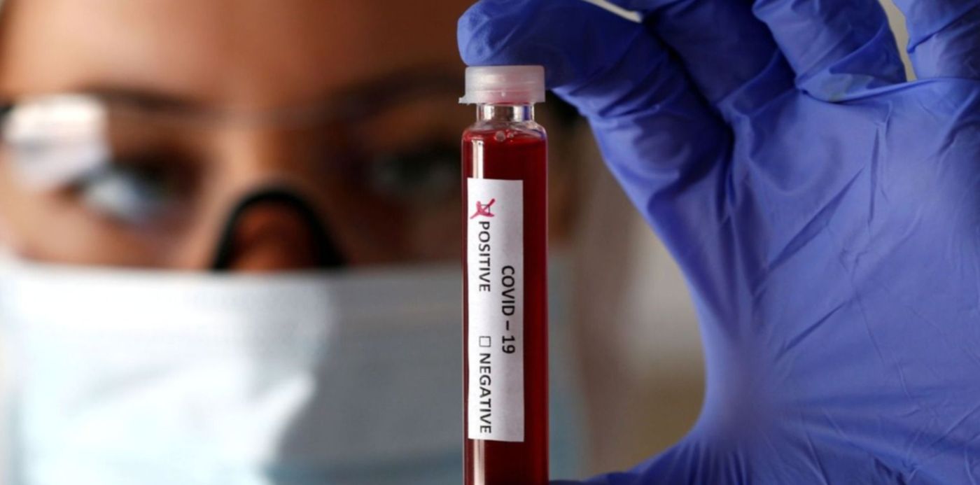 1646657355765.jpg?x=5&y=100&width=1487&height=743&rotate=0&scaleX=1&scaleY=1&ow=1500&oh=843&&cw=1920&ch=950