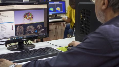 Investigadores de la UNLP avanzan en el diagnóstico temprano de enfermedades neurológicas