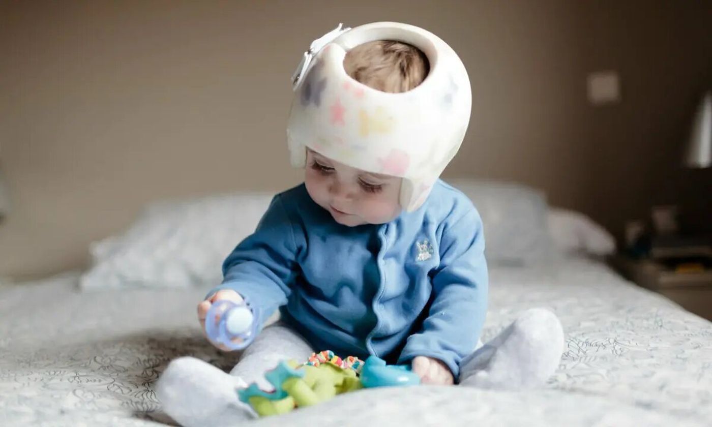 1-plagiocefalia-el-motivo-por-el-que-algunos-bebes-deben-usar-casco-4365.jpg