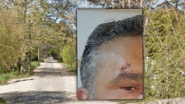 el dramatico relato de una madrugada de terror en el barrio el rincon