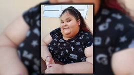 tiene un severo cuadro de salud, la operaron ocho veces y necesita ayuda para recuperarse tiene un severo cuadro de salud, la operaron ocho veces y necesita ayuda para recuperarse