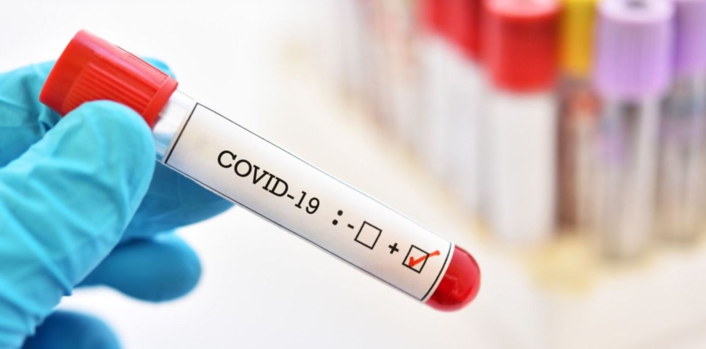 1585424742908.jpg?x=10&y=93&width=1480&ow=1500&oh=1000&height=740&rotate=0&scaleX=1&scaleY=1&&cw=1920&ch=950