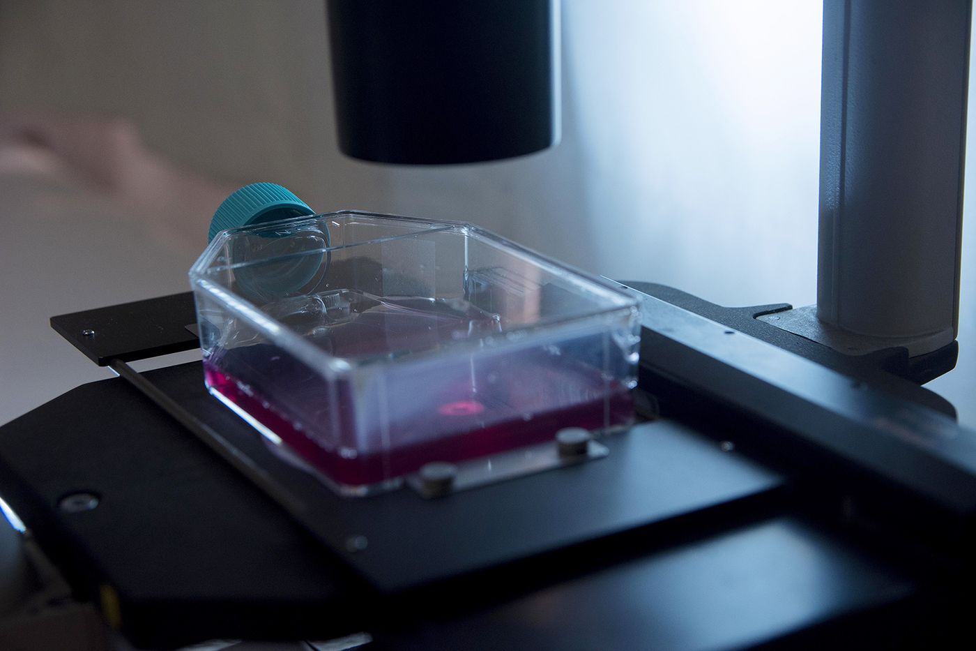 Investigadores de la UNLP demostraron que el Alzheimer también debilita los huesos y proponen abordarlo junto a la osteoporosis
