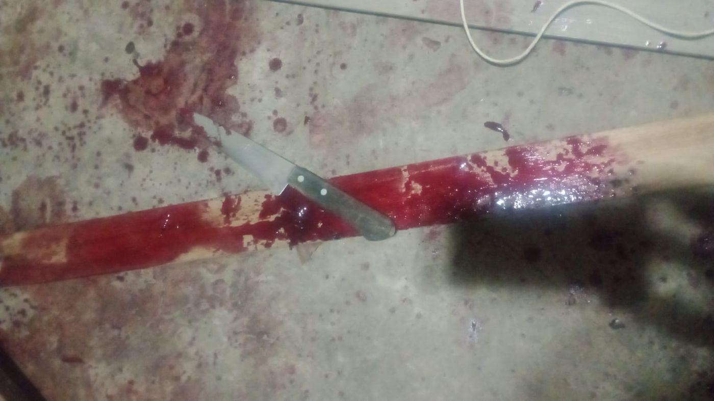 El hombre le asest&oacute; varias pu&ntilde;aladas al hijo de su pareja en su vivienda de La Plata. 