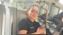 una oficial del servicio penitenciario iba a su trabajo en micro y termino herida tras recibir un botellazo una oficial del servicio penitenciario iba a su trabajo en micro y termino herida tras recibir un botellazo